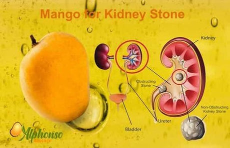 Harness the Power of Mango for Kidney Stone Prevention - AlphonsoMango.in